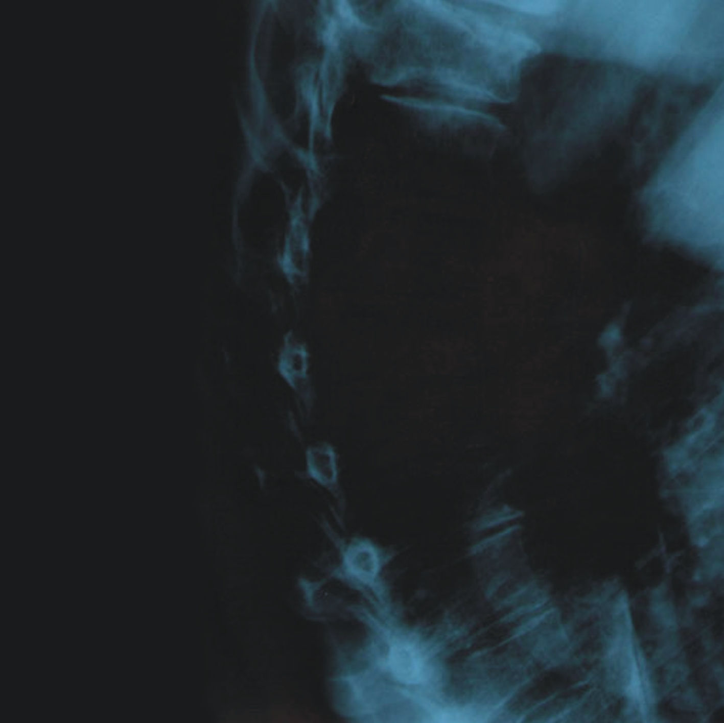 EA - II (CD Jewel Case)