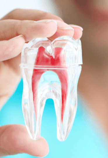 endodoncia.png