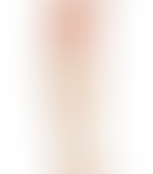 外側上顆炎（テニス肘）について