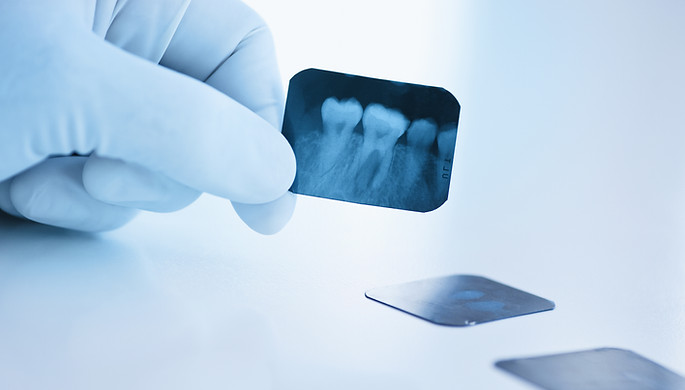 Film radiographique dentaire