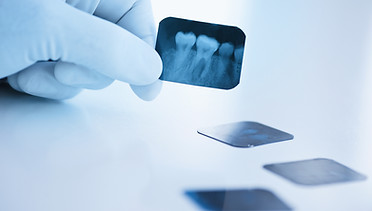 Dental x-ray