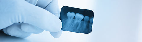 Radiografía dental