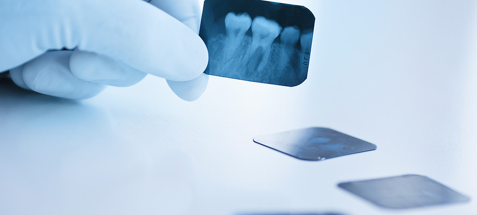 Dental x-ray