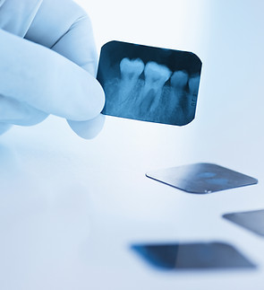 Dental x-ray