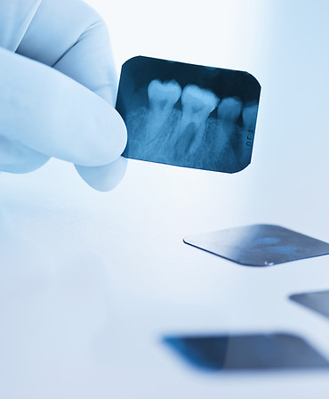 Filme de raio-X dental