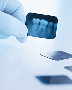 Radiografía dental