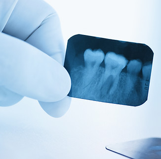 Radiografía dental