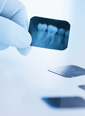 Dental x-ray