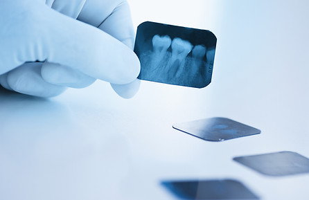 Dental x-ray