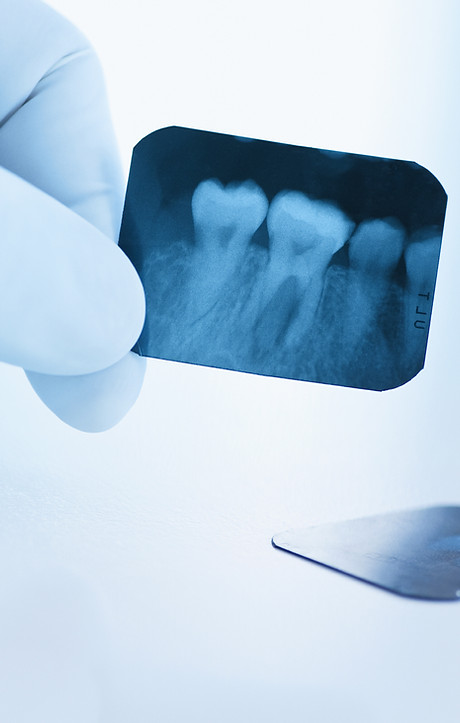 Dental x-ray