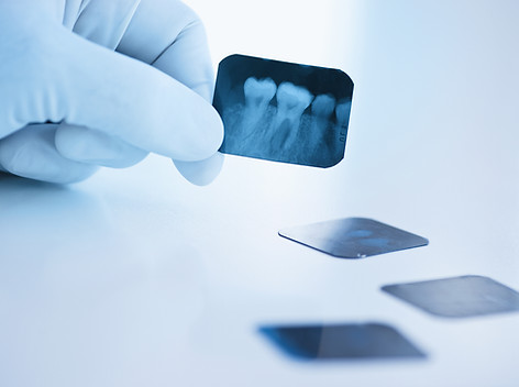 Dental x-ray