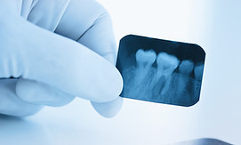Dental-Röntgen