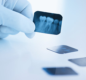 Dental x-ray