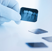 Dental x-ray