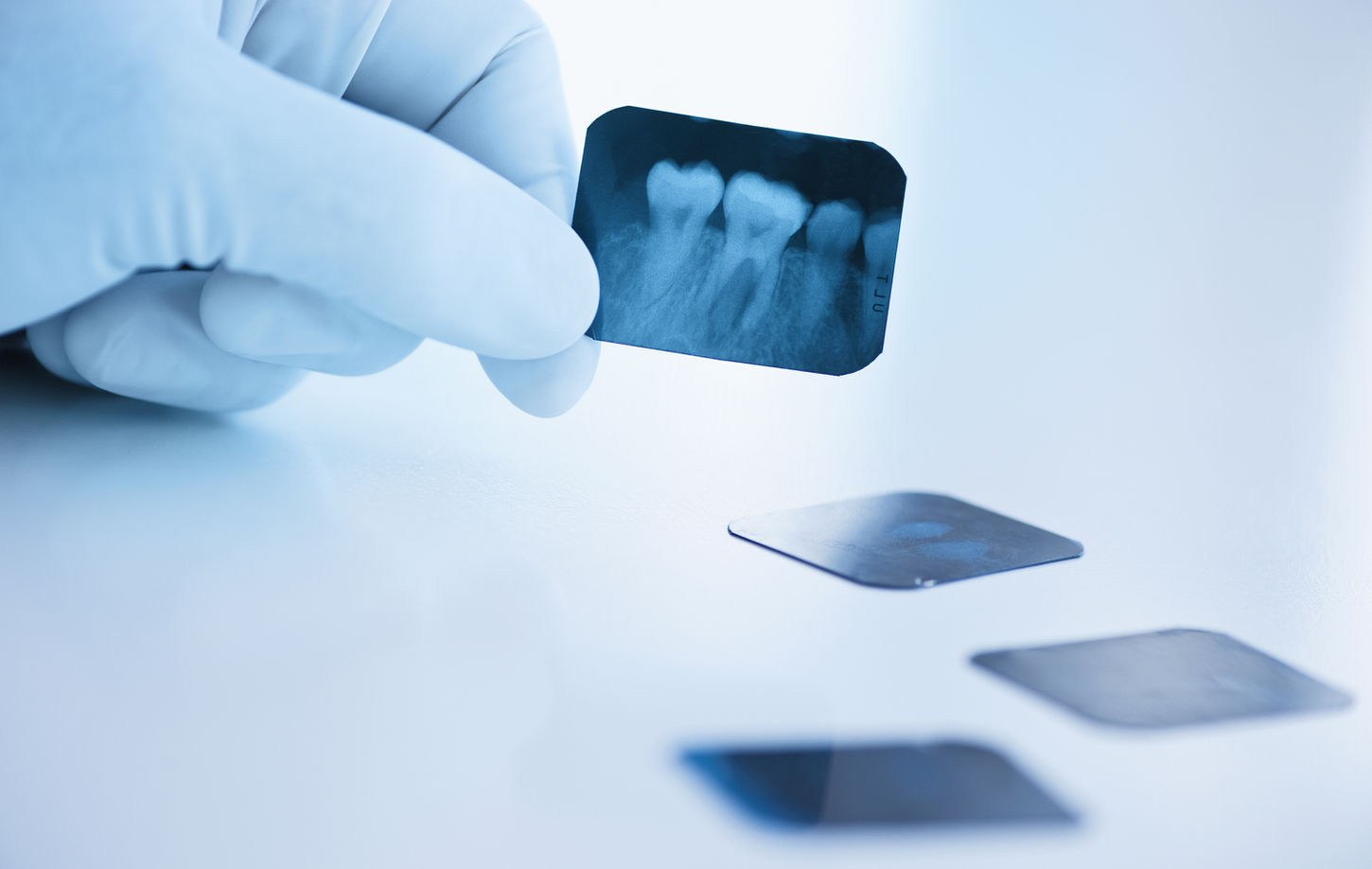 Dental x-ray