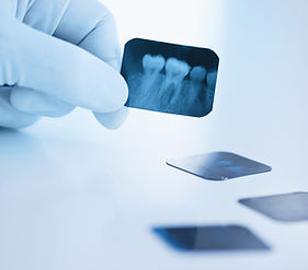 Dental x-ray