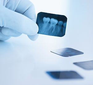 Dental x-ray