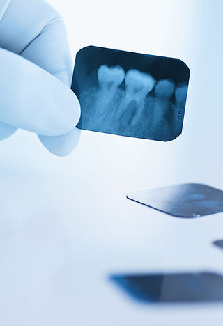 Dental x-ray