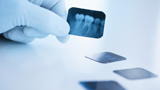 Dental x-ray