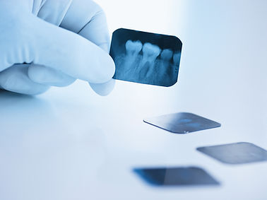 RadiografÃa dental