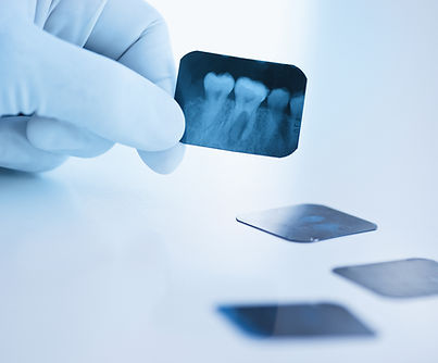 Dental X-Ray Closeup