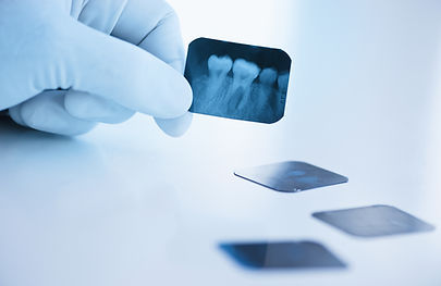 Dental x-ray