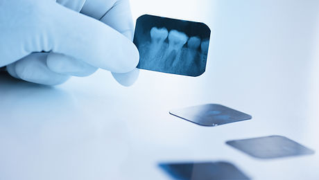 Dental x-ray