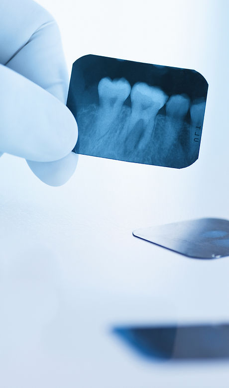 Dental-Röntgen