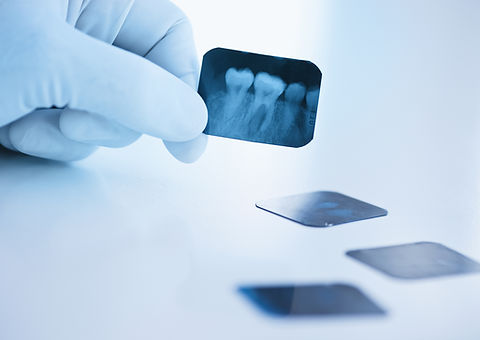 Dental x-ray