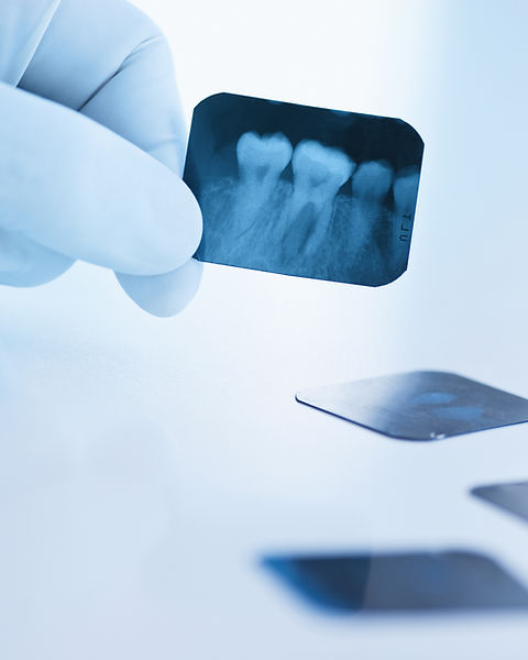 Dental x-ray