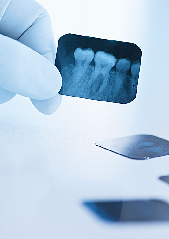 Dental x-ray