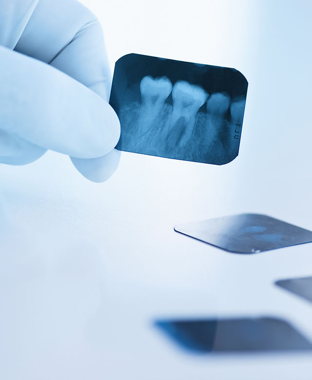 Dental x-ray