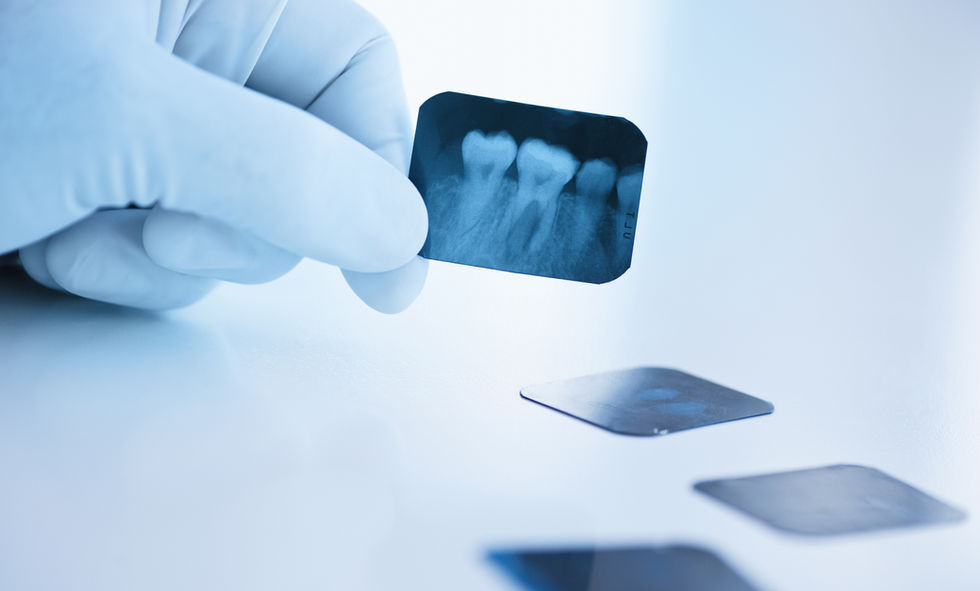 Dental x-ray