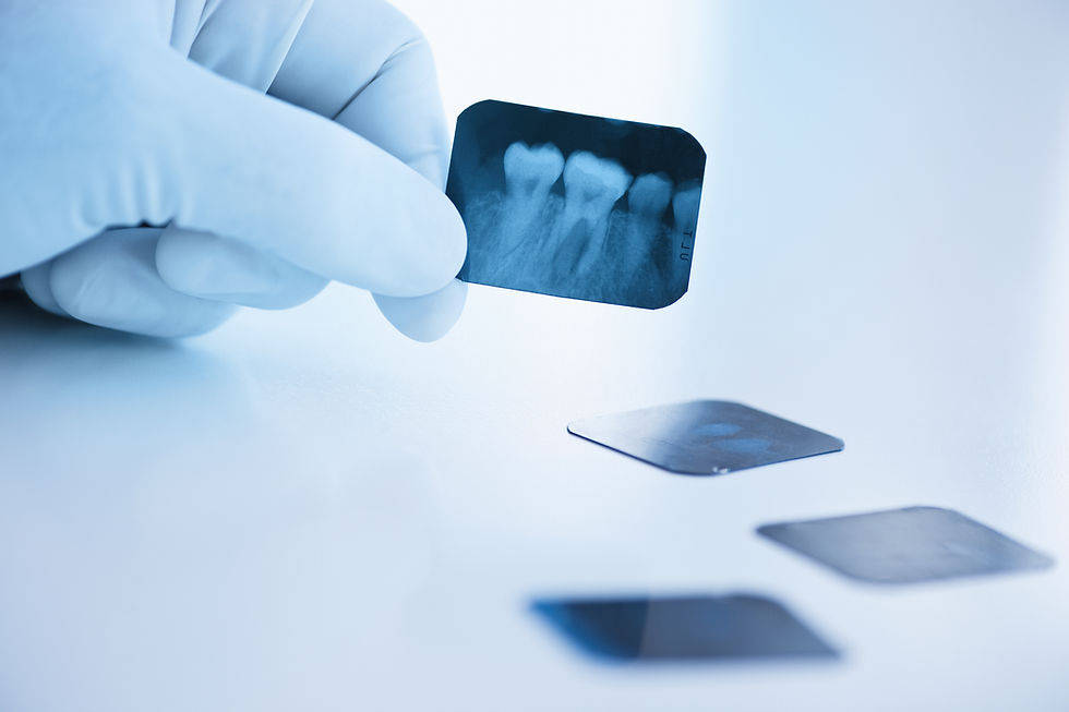 Radiografia dentária em close-up
