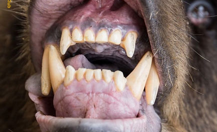 GB teeth_edited.jpg