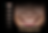 Why Do Celebrities Get Their Teeth Done in Brazil? The Luxury Smile Secret Revealed
