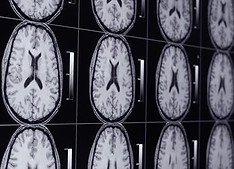 mri2.jpg