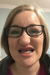 Crystal Before.jpeg