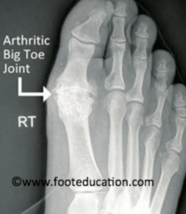 foot x-ray.
