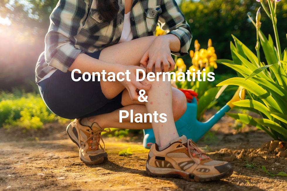 Contact dermatitis and plants