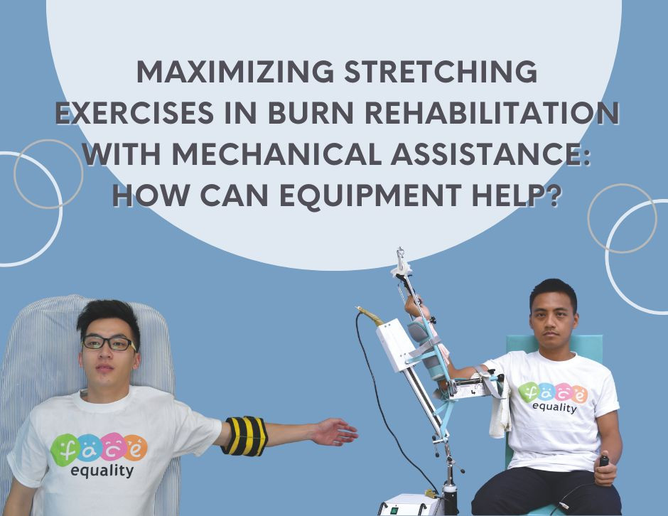 RoboTherapy Burn Rehabilitation System