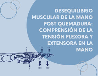 Desequilibrio muscular de la mano post quemadura: Comprensión de la Tensión Flexora y Extensora en la Mano