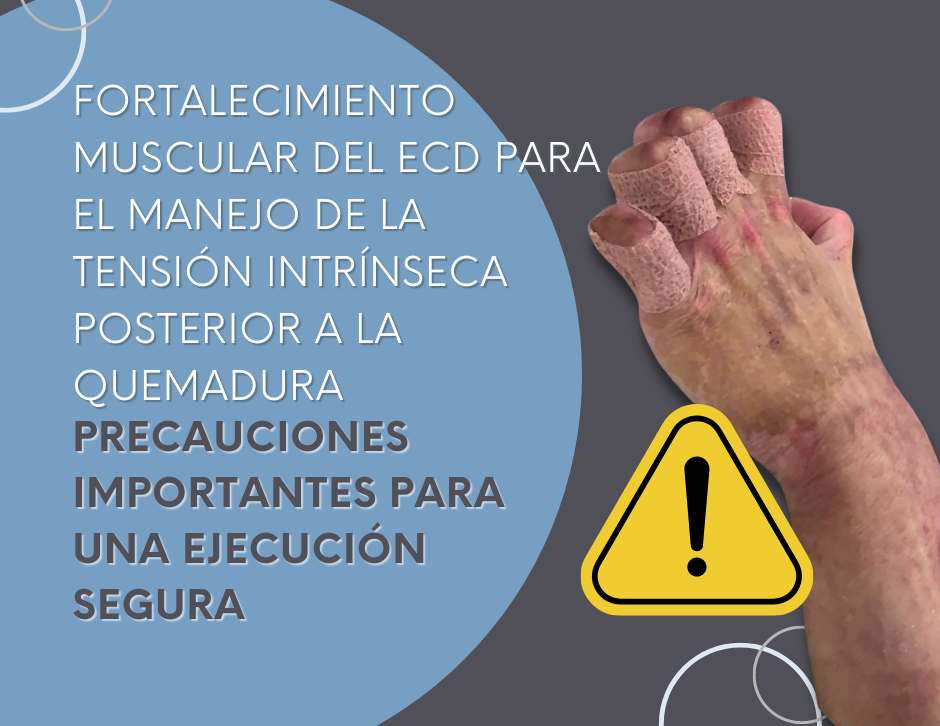 Ejercicio de fortalecimiento muscular del ECD para la tensión intrínseca post-quemadura