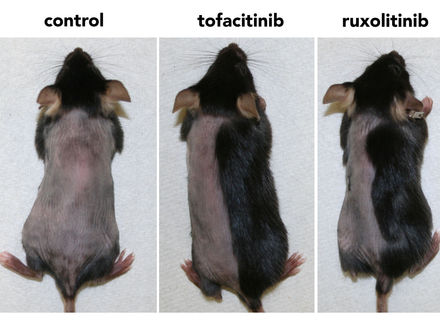 Arthritis drug may spur hair growth topically