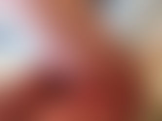 AAD releases pediatric AD guidelines