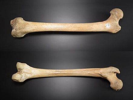 Key mechanism of bone destruction in melanoma bone destruction identified