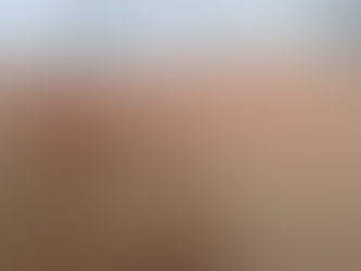 Eczema, other inflammatory conditions may increase post-surgery complications