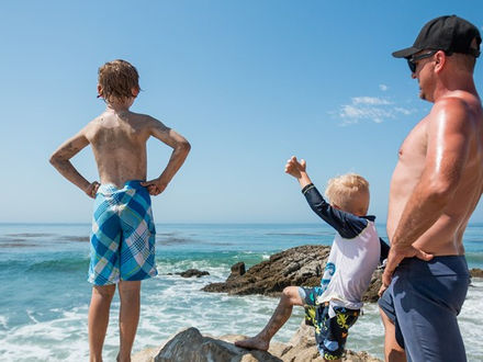 Four ways to get a sunburn, and six ways to cure the damage