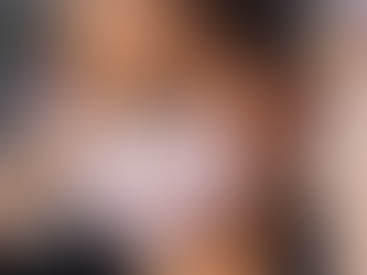 VIDEO: Mask wearing may lead to worsening rosacea symptoms