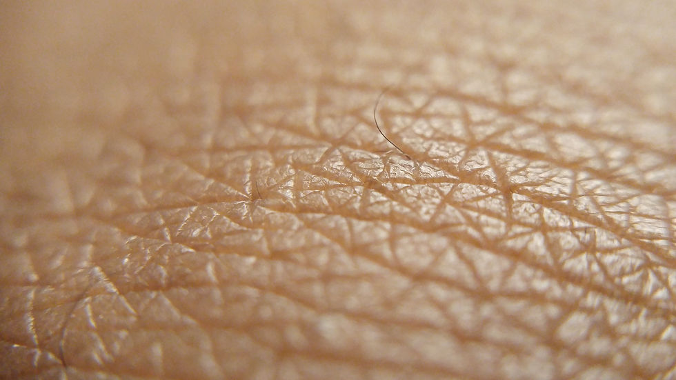 Umbilical cord-derived mesenchymal stem cell conditioned medium may reduce skin aging